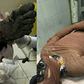 حوادث چهارشنبه آخر سال؛ ۳ فوتی و ۲۴ قطع‌عضوی