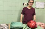 خارج کردن توده ۱۰ کیلوگرمی از شکم بیمار در  رودسر