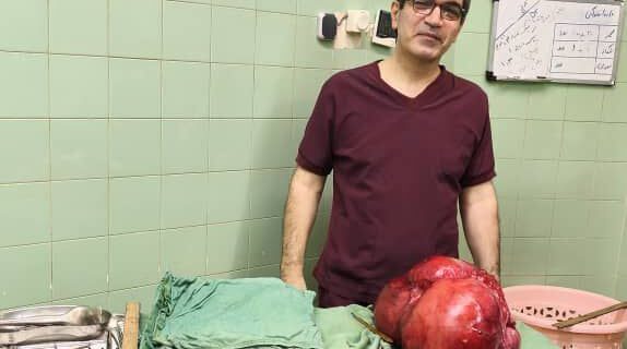 خارج کردن توده ۱۰ کیلوگرمی از شکم بیمار در  رودسر